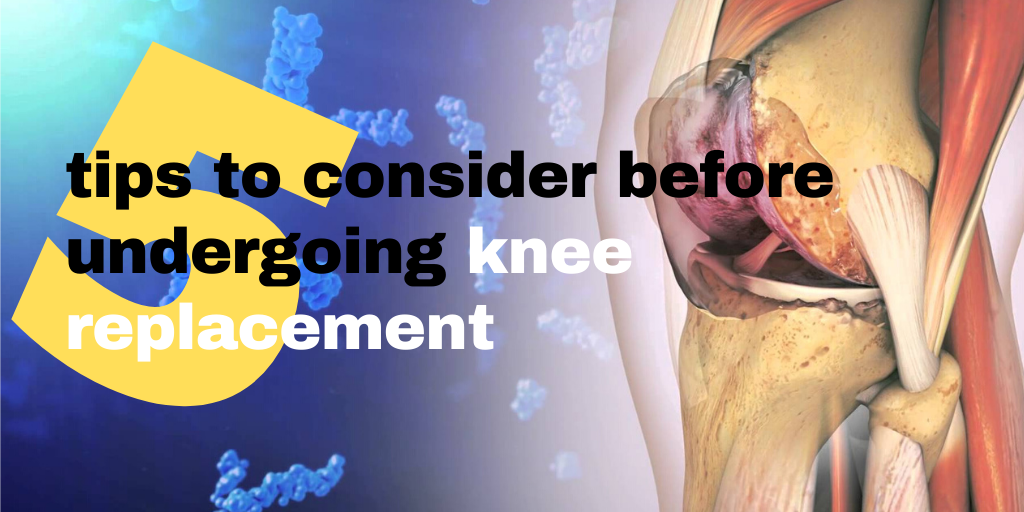 5 tips to consider before undergoing knee replacement