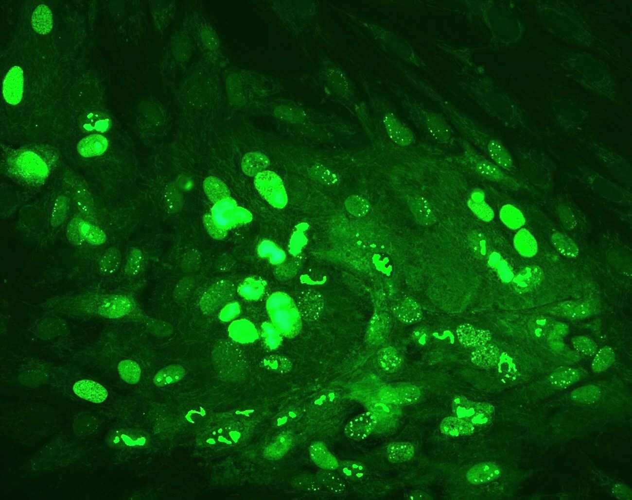 Fluorescent Antibody Test- An Effective Diagnostic Technique