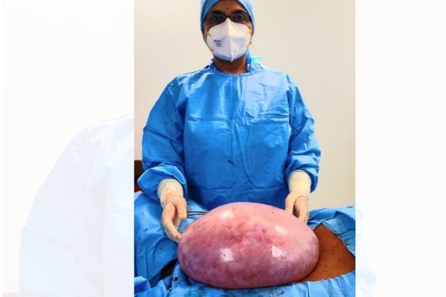 7.5 Kgs Ovarian Tumor successfully removed from 43-year-Old Lady at Fortis Hospital, Bannerghatta Road